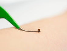 Load image into Gallery viewer, Premium Tick Remover Kit